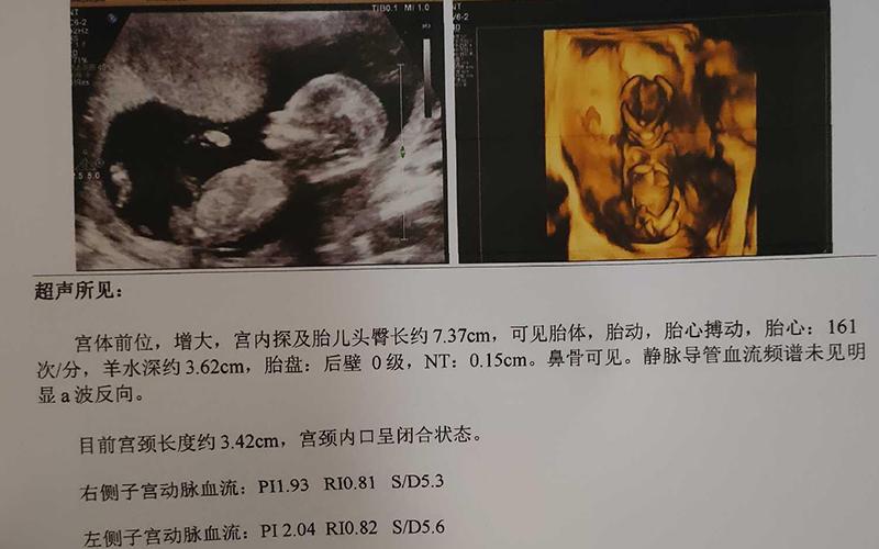 北京三代供卵试管双胞胎【北京三代供卵试管双胞胎：新生命的奇迹】