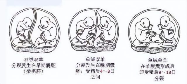 供卵试管代怀包双胞胎-双胞胎梦想实现供卵试管代怀包双胞胎助你圆梦
