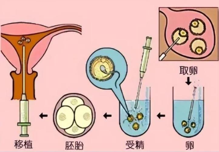 供卵试管以后的弊端(供卵试管：弊端揭秘)